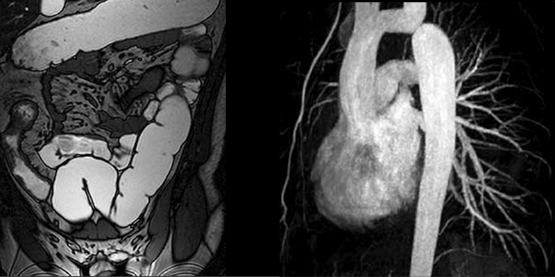 Cardiac